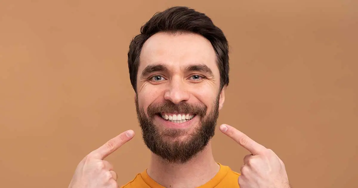 transplante de barba e bigode